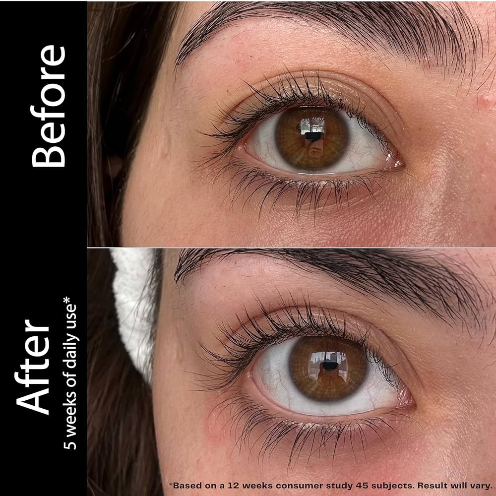 アイケア EXOSTRONG eyelash serum 3mL Amazon.com: Lash Therapy Australia Lash Serum 3ml : Beauty